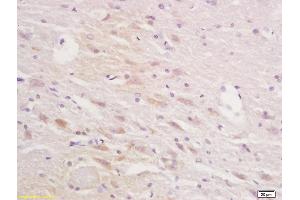 Formalin-fixed and paraffin embedded rat brain tissue labeled with Anti-Squalene EpoxidasePolyclonal Antibody, Unconjugated (ABIN705401) at 1:200 followed by conjugation to the secondary antibody and DAB staining (SQLE Antikörper  (AA 101-200))