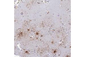 Immunohistochemical staining of human lateral ventricle with ASUN polyclonal antibody  shows distinct positivity in astrocytes and neuropil at 1:200-1:500 dilution. (C12orf11 Antikörper)