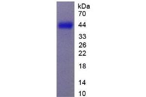 SDS-PAGE analysis of Rat CSPG5 Protein.