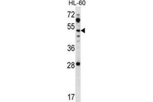 ZIC1 Antibody (N-term) western blot analysis in HL-60 cell line lysates (35 µg/lane). (ZIC1 Antikörper  (N-Term))