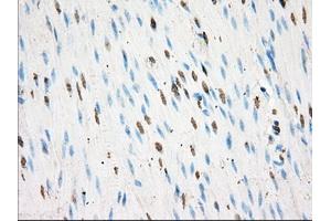 Immunohistochemical staining of paraffin-embedded colon tissue using anti-BSG mouse monoclonal antibody. (CD147 Antikörper)