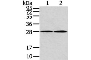 Western Blot analysis of Mouse heart and lung tissue using KCNMB1 Polyclonal Antibody at dilution of 1/500