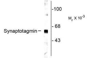 Image no. 1 for anti-Synaptotagmin I (SYT1) antibody (ABIN372723) (SYT1 Antikörper)