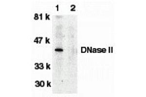 Western Blotting (WB) image for anti-Deoxyribonuclease II, Lysosomal (DNASE2) antibody (ABIN1031743) (DNASE2 Antikörper)