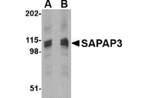 Western Blotting (WB) image for anti-Discs, Large (Drosophila) Homolog-Associated Protein 3 (DLGAP3) (C-Term) antibody (ABIN1030637) (DLGAP3 Antikörper  (C-Term))