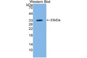 Western blot analysis of the recombinant protein. (LCP2 Antikörper  (AA 202-463))