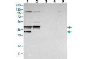 Western blot analysis of Lane 1: RT-4, Lane 2: U-251 MG, Lane 3: Human Plasma, Lane 4: Liver, Lane 5: Tonsil with EBNA1BP2 polyclonal antibody  at 1:250-1:500 dilution.