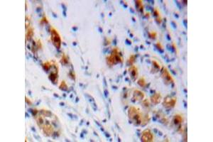 Used in DAB staining on fromalin fixed paraffin-embedded Stomach tissue (LHB Antikörper  (AA 23-141))