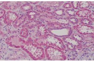 Human Kidney: Formalin-Fixed, Paraffin-Embedded (FFPE) (GSTM1 Antikörper  (AA 1-159))