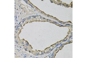 Immunohistochemistry of paraffin-embedded human prostate using LCN1 antibody at dilution of 1:100 (x40 lens). (Lipocalin 1 Antikörper)