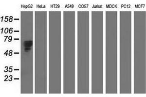 Western blot analysis of extracts (35 µg) from 9 different cell lines by using anti-AFP monoclonal antibody. (alpha Fetoprotein Antikörper)