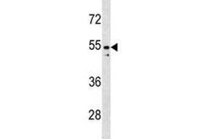 PAX2 antibody western blot analysis in K562 lysate (PAX2A Antikörper  (AA 187-216))