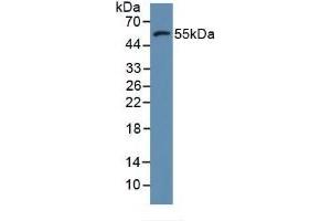 Detection of MMP11 in Human MCF7 Cells using Polyclonal Antibody to Matrix Metalloproteinase 11 (MMP11) (MMP11 Antikörper  (AA 287-491))