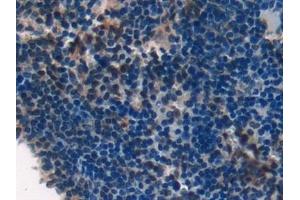 Immunohistochemistry (IHC) image for anti-Laminin, alpha 1 (LAMA1) (AA 2640-2773) antibody (ABIN7432094)