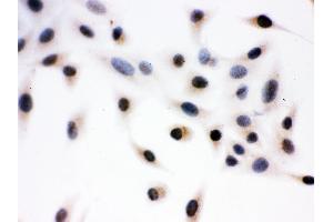Immunohistochemistry (IHC) image for anti-Death-Domain Associated Protein (DAXX) (AA 56-345) antibody (ABIN3043822)
