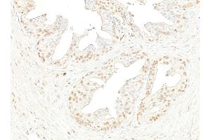 Immunohistochemistry (IHC) image for anti-Bromodomain Containing 4 (BRD4) (AA 1312-1362) antibody (ABIN7453424)