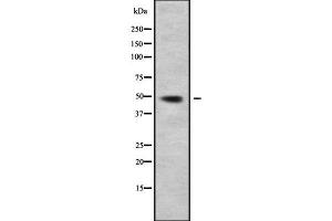 Western blot analysis of CLP1 using LOVO whole cell lysates (CLP1 Antikörper)