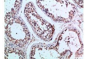 Immunohistochemical analysis of paraffin-embedded Human-testis, antibody was diluted at 1:100. (PIK3R2 Antikörper  (AA 1-60))
