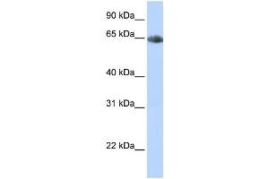 Western Blotting (WB) image for anti-Solute Carrier Family 6 (Neurotransmitter Transporter, Noradrenalin), Member 2 (SLC6A2) antibody (ABIN2458614) (SLC6A2 Antikörper)