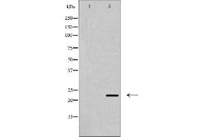 Western blot analysis of CLDN6 expression in Jurkat cells,The lane on the left is treated with the antigen-specific peptide. (Claudin 6 Antikörper  (Internal Region))