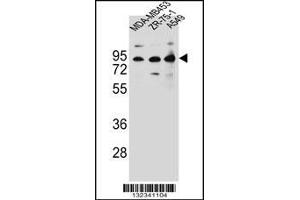 Western blot analysis in MDA-MB453,ZR-75-1,A549 cell line lysates (35ug/lane). (CTTNBP2NL Antikörper  (N-Term))