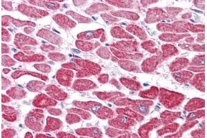 Human Heart: Formalin-Fixed, Paraffin-Embedded (FFPE) (RSPO1 Antikörper  (N-Term))
