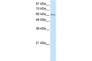 WB Suggested Anti-PRMT5 Antibody Titration:  2. (PRMT5 Antikörper  (N-Term))