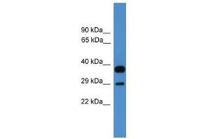 OTUB2 antibody used at 0. (OTUB2 Antikörper  (Middle Region))