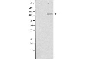Western Blotting (WB) image for anti-SWI/SNF Related, Matrix Associated, Actin Dependent Regulator of Chromatin, Subfamily A, Member 5 (SMARCA5) (C-Term) antibody (ABIN6265180)