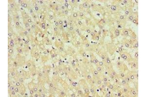 Immunohistochemistry of paraffin-embedded human liver tissue using ABIN7157655 at dilution of 1:100 (KIF6 Antikörper  (AA 565-814))