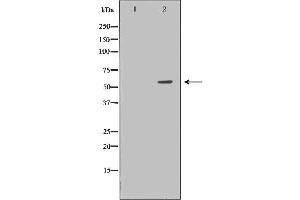 Western blot analysis of Hela whole cell lysates, using DKC1 Antibody.