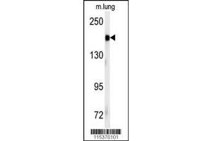 Image no. 1 for anti-Insulin Receptor (INSR) (Tyr1185) antibody (ABIN381200) (Insulin Receptor Antikörper  (Tyr1185))