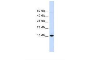 Image no. 1 for anti-D-Dopachrome Tautomerase (DDT) (N-Term) antibody (ABIN6738204)