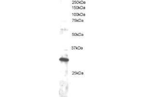 ABIN2562232 staining (1µg/ml) of Jurkat lysate (RIPA buffer, 30µg total protein per lane). (DKK4 Antikörper  (C-Term))