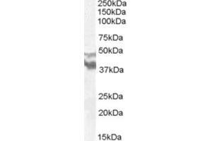 Western Blotting (WB) image for anti-Dyslexia Susceptibility 1 Candidate 1 (DYX1C1) (N-Term) antibody (ABIN2466680) (DYX1C1 Antikörper  (N-Term))
