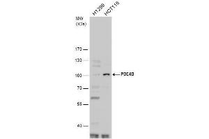 WB Image PDE4B antibody detects PDE4B protein by western blot analysis. (PDE4B Antikörper  (C-Term))