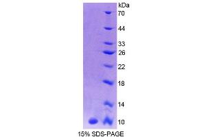 SDS-PAGE analysis of Human CALY Protein.
