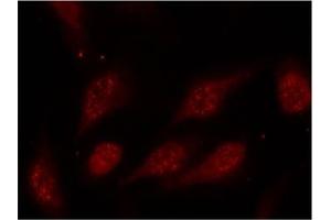 Image no. 2 for anti-Tumor Protein P53 (TP53) (pSer315) antibody (ABIN196788) (p53 Antikörper  (pSer315))