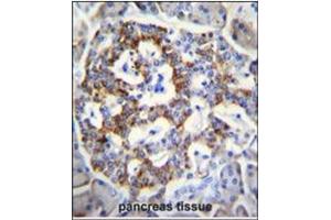 Immunohistochemistry (Paraffin-embedded Sections) (IHC (p)) image for anti-Sema Domain, Immunoglobulin Domain (Ig), Short Basic Domain, Secreted, (Semaphorin) 3G (SEMA3G) (AA 223-252), (Middle Region) antibody (ABIN954720)