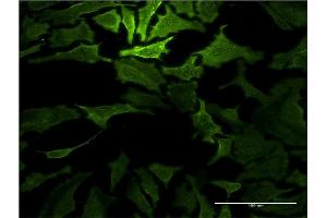 Immunofluorescence of monoclonal antibody to RASA1 on HeLa cell. (RASA1 Antikörper  (AA 948-1047))