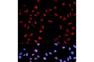 Immunofluorescence analysis of MCF-7 cells using Phospho-AKT(T450) Polyclonal Antibody (AKT1 Antikörper  (pThr450))