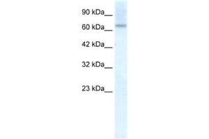 Western Blotting (WB) image for anti-Protein Inhibitor of Activated STAT, 2 (PIAS2) antibody (ABIN2461198) (PIAS2 Antikörper)