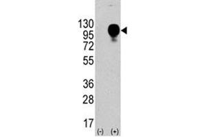 Western blot analysis of CD107b antibody and 293 cell lysate nontransfected or transfected. (LAMP2 Antikörper  (AA 196-225))