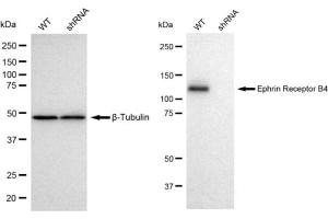 Western blotting analysis using Ephrin Receptor B4 antibody (ABIN7798459). (Rekombinanter Ephrin Receptor B4 Antikörper)