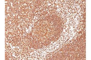 Formalin-fixed, paraffin-embedded human Tonsil stained with CD45 Mouse Monoclonal Antibody (2B11+PD7/26).