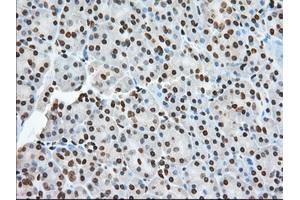 Immunohistochemical staining of paraffin-embedded Human colon tissue using anti-TACC3 mouse monoclonal antibody. (TACC3 Antikörper)