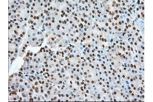 Immunohistochemical staining of paraffin-embedded Human colon tissue using anti-TACC3 mouse monoclonal antibody.