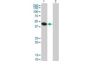 Western Blot analysis of RNF133 expression in transfected 293T cell line by RNF133 monoclonal antibody (M01), clone 3D6. (RNF133 Antikörper  (AA 277-376))