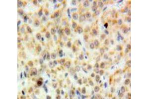 Used in DAB staining on fromalin fixed paraffin-embedded Ovary tissue (DDB2 Antikörper  (AA 166-383))
