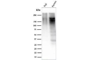 Western Blot Analysis of Raji and Ramos cell lysate using Ki67 Mouse Monoclonal Antibody (MKI67/2463). (Ki-67 Antikörper  (AA 2293-2478))